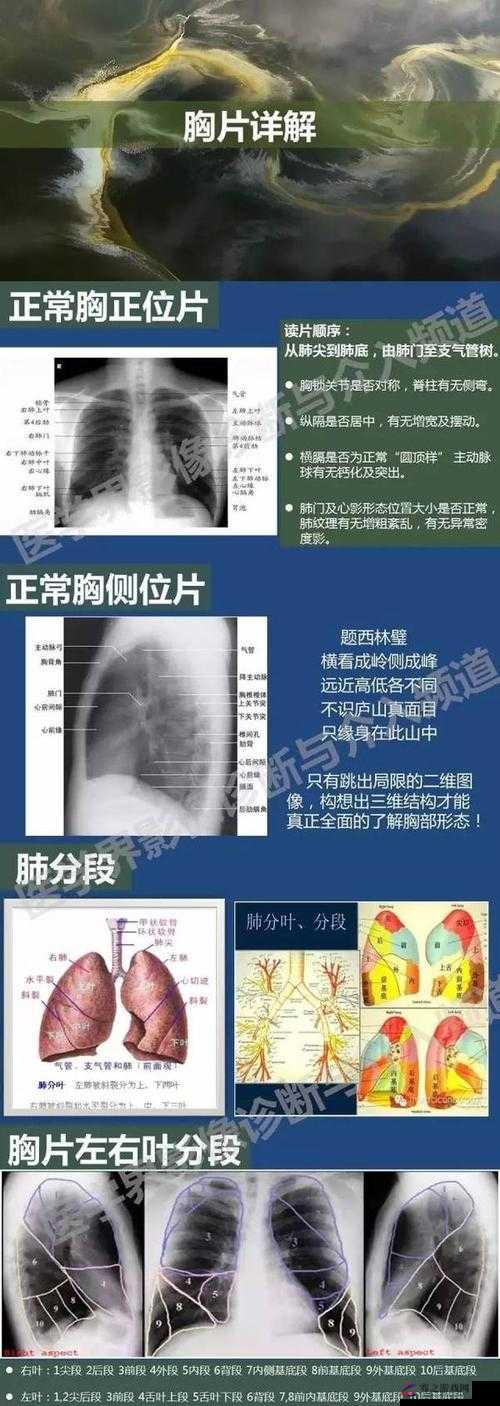 100%胸片曝光率免费且全免费为民众健康保驾护航