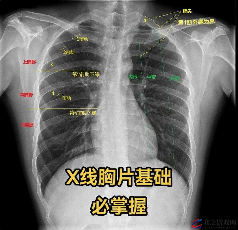 100%胸片曝光：对医学诊断的重要性及应用探讨