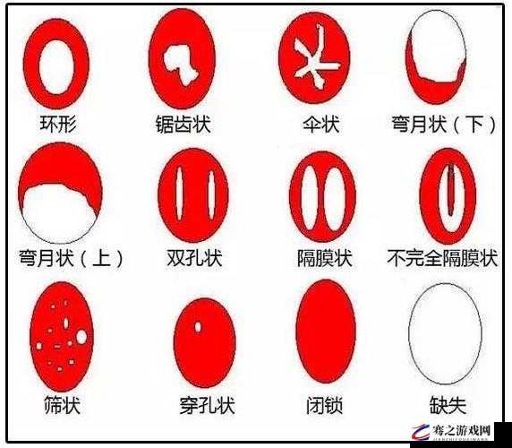 阴脣肥大的图示蝴蝶：性征与健康的警示